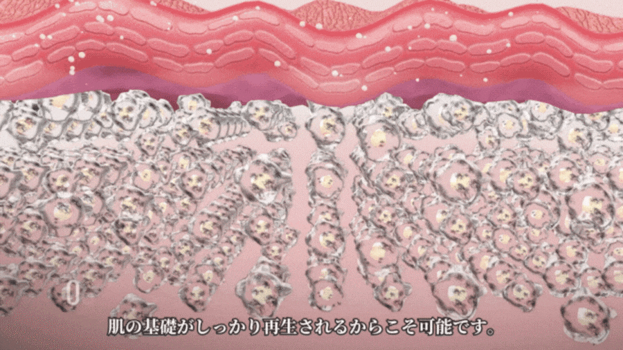[EMMA Blog 特別企画]  LuciDor Exo-kit